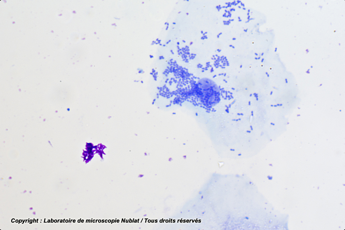 Bacille tuberculeux de Koch, expectoration, Ziehl Neelsen